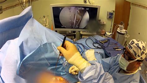 Arthroscopic Shoulder Bankart and SLAP Repair Surgery Filmed on GoPro ...