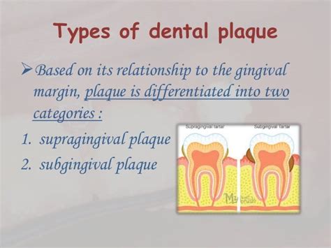 Dental plaque formation