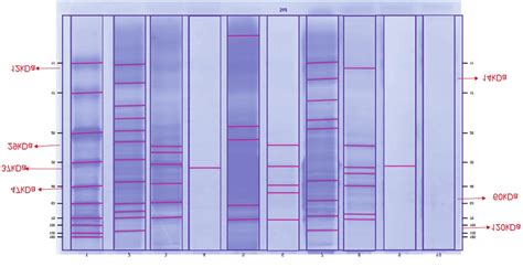 Results of electrophoresis. kDa = molecular weight in kilo dalton, lane ...