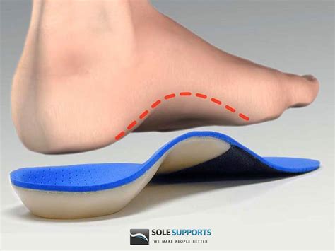 Orthotics & Plantar Fasciitis - Thrive Chiropractic in Minnetonka, MN