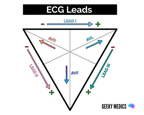 What is Cardiac Axis? | ECG Interpretation | Geeky Medics