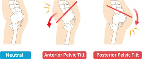 Anterior Pelvic Tilt: How To Correct Imbalances & Improve Performance - I Love Bicycling