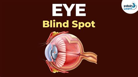 Blind Spot – Telegraph