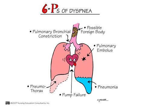 Dyspnea