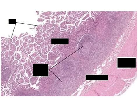 Peyer's patch histology Quiz