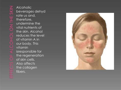 Alcohol In Skin Care / Hyperpigmentation, Rosacea, Wrinkles, and Acne ...