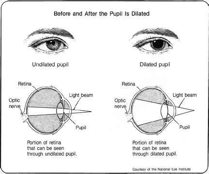 Dilated Eye Examination