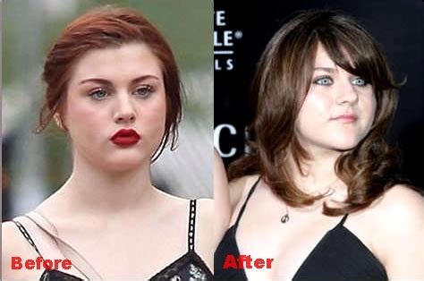 Frances Bean Cobain Nose Job Plastic Surgery Before And After