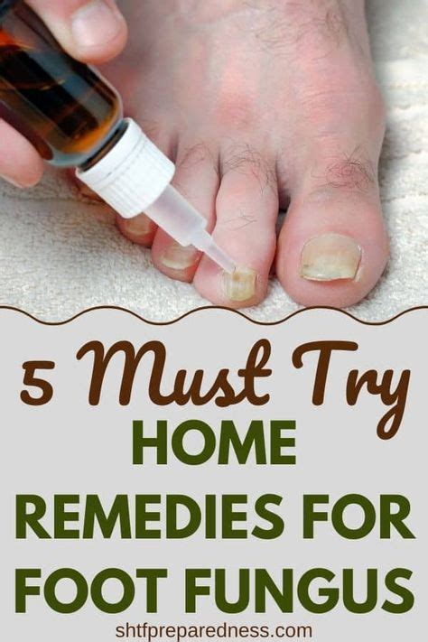 5 Must Try Home Remedies for Foot Fungus in 2020 | Foot fungus remedies ...