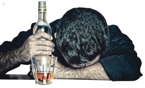 Alcoholismo: qué es, síntomas y tratamiento | Top Doctors