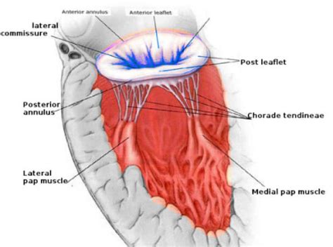 Mitral Annulus Disjunction - Perfusfind