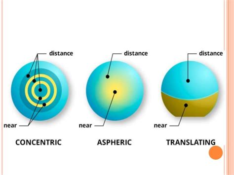 Multifocal Contact Lenses - Millennium Eye Center