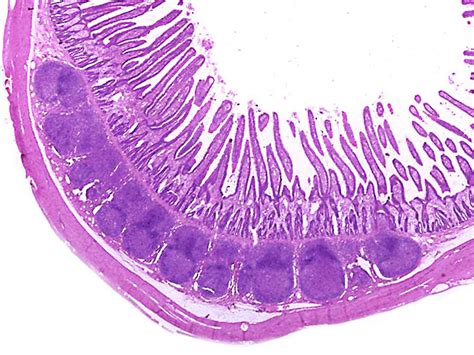 Ileum