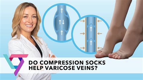 Compression Stockings For Varicose Veins Miami Vein Center ...