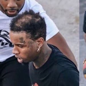 Tory Lanez gets roasted on Twitter, after images of his bald spot surface