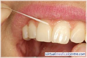 Dental hygiene (proper brushing and flossing techniques) | myVMC