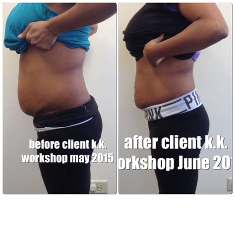 All New Before and After Pictures – Healing the Diastasis Recti 2015 ...