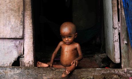 Over 40% of Indian children are malnourished, report finds | World news ...