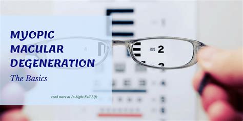 What Is Myopic Macular Degeneration? | Macular degeneration, Eye health, Basic