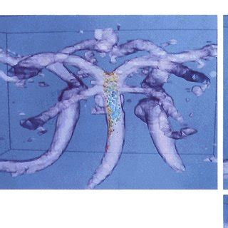 A noninvasive simulation of a bolus injection derived from MR data a ...