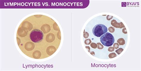 Difference Between Monocytes and Lymphocytes Under Microscope.