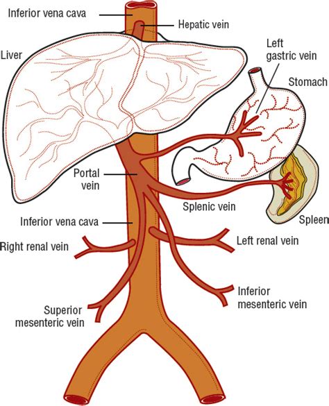 Portal Hypertension and Cirrhosis | Basicmedical Key