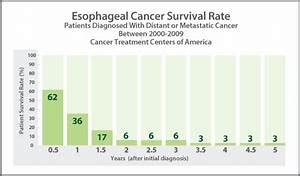 Mesothelioma Life Expectancy | MESOTHELIOMA HEALTH CANCER