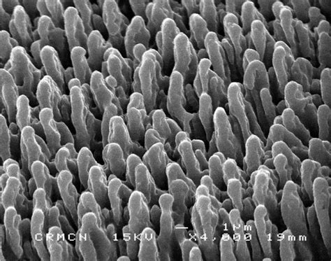 'Bed-of-Nails' Surface Physically Rips Bacteria Apart | American Council on Science and Health