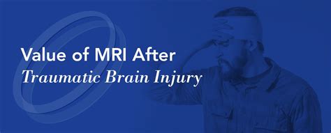 Value of MRI After Traumatic Brain Injury - Health Images