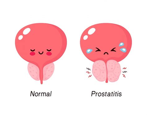 Premium Vector | Normal prostate and benign prostatic hyperplasia. cute ...