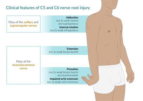 Axillary Nerve Damage