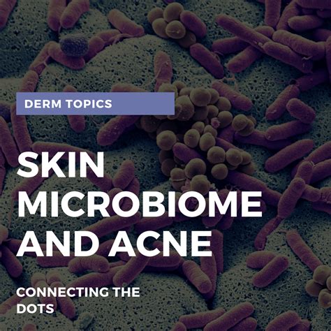 Skin Microbiome and Acne: Connecting the Dots - Next Steps in Dermatology