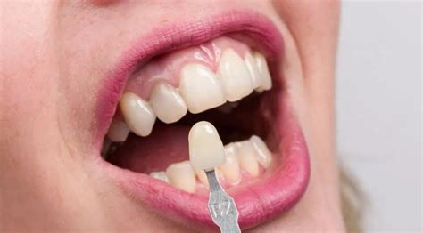 Side Effects And Risk Factors Of Dental Implants - Canyon Vista Dental