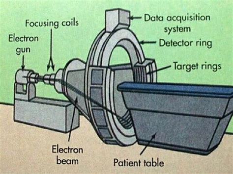 Computed Tomography (CT)