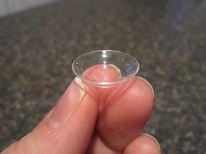 Patient with keratoconus talks about Laserfit lenses