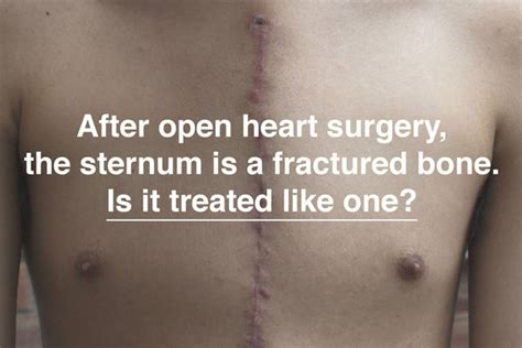 After open heart surgery, the sternum is a fractured bone. Is it treat ...