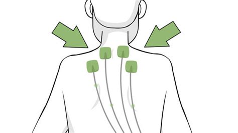 Matchless Tips About How To Get Rid Of Crick In Neck - Feeloperation