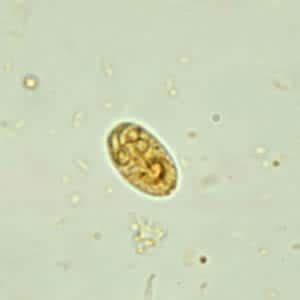 CDC - DPDx - Giardiasis