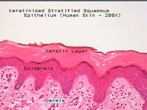 Stratified squamous epithelial tissue-skin.Protects. | Stratified squamous epithelium, Squamous ...