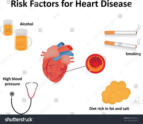 Risk Factors Heart Disease Labeled Diagram Stock Illustration 307036523 ...