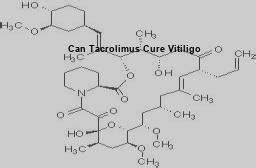 Can tacrolimus cure vitiligo, protopic tacrolimus ointment vitiligo ...