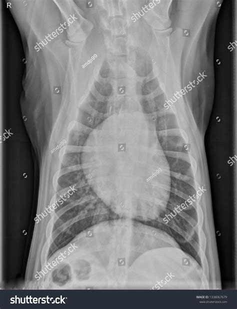 Normal Ventrodorsal Thoracic Chest Xray Radiograph : illustration de stock 1338067679 | Shutterstock