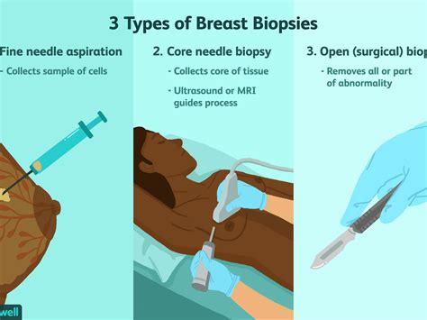 Biopsy Types : A Specimen Types And B Analytes For Liquid Biopsy Download Scientific Diagram ...