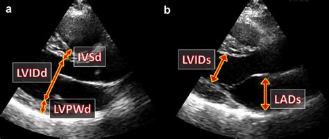 (a) Example measurements of the interventricular septum thickness ...