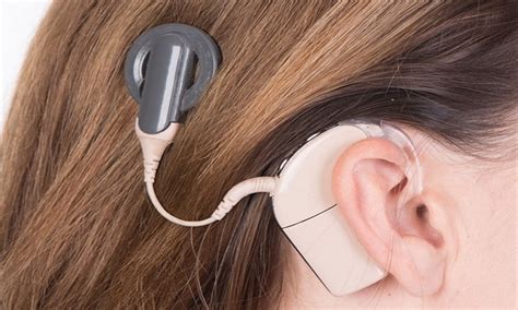 New cochlear implant device ensures safety and comfort in kids during MRI