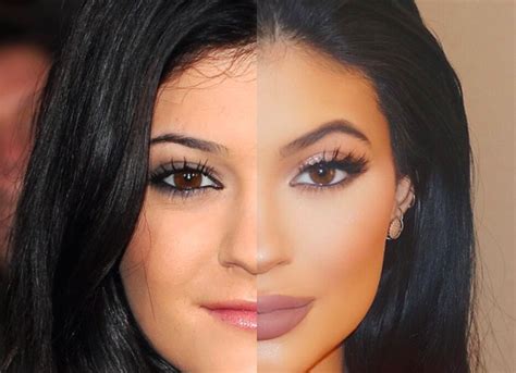 Kylie Jenner Before and After (What She Really Looks Like) - TSC