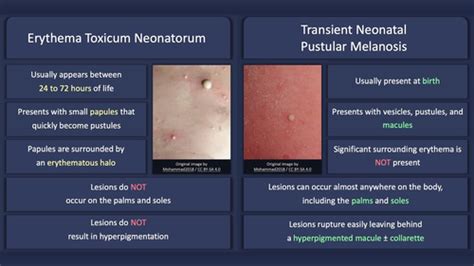 STEP 2 - Dermatology | Quizlet