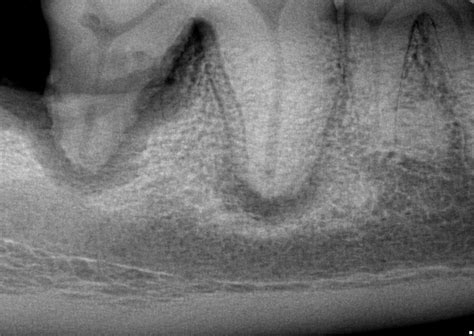 Teeth: perio-endo lesion - radiograph in Dogs (Canis) | Vetlexicon