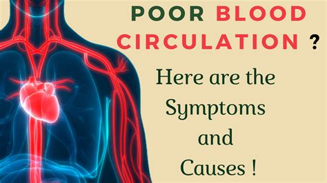 Poor Blood Circulation; Symptoms and Causes