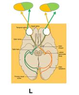 Optic Nerve lesions Flashcards | Quizlet